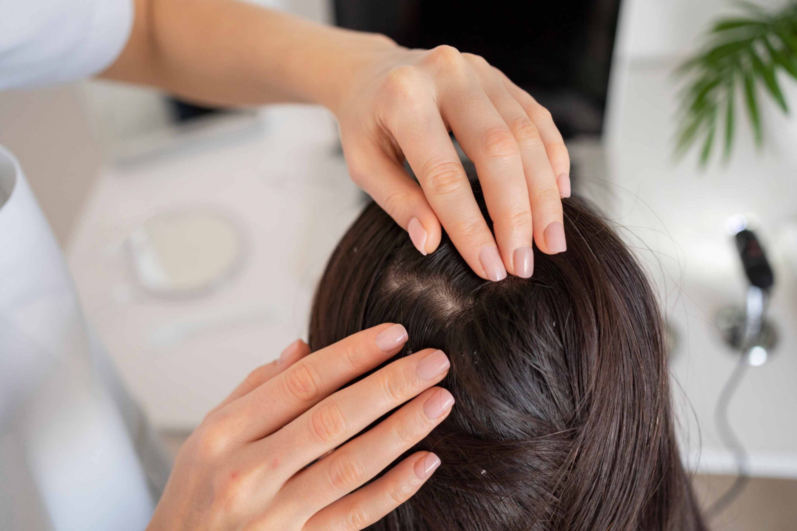 Scalp Yeast Infection: Causes, Symptoms