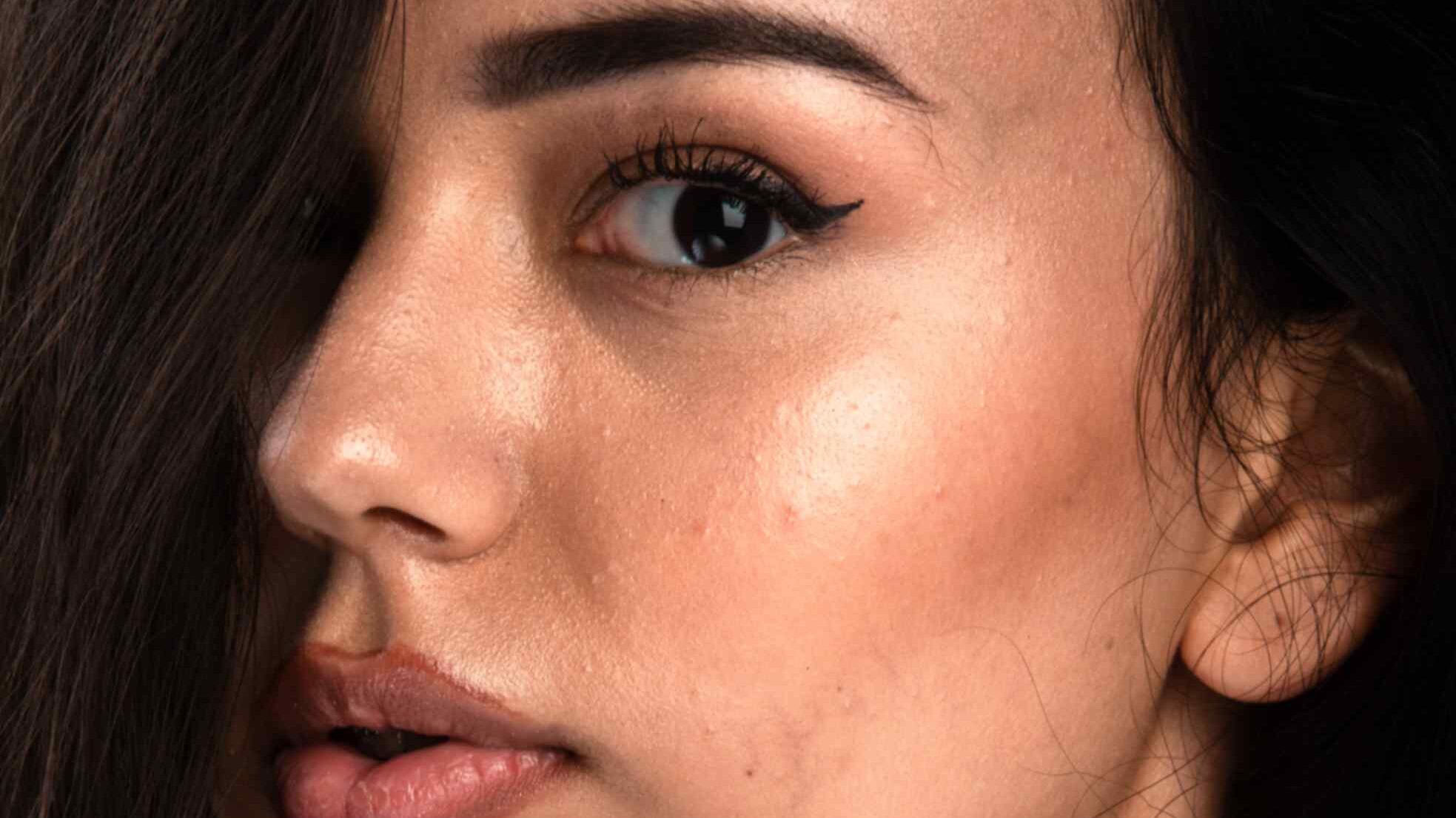 Dull Skin